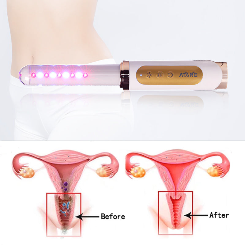Post-Pregnancy Recovery Intimate Tightening Devices for New Moms